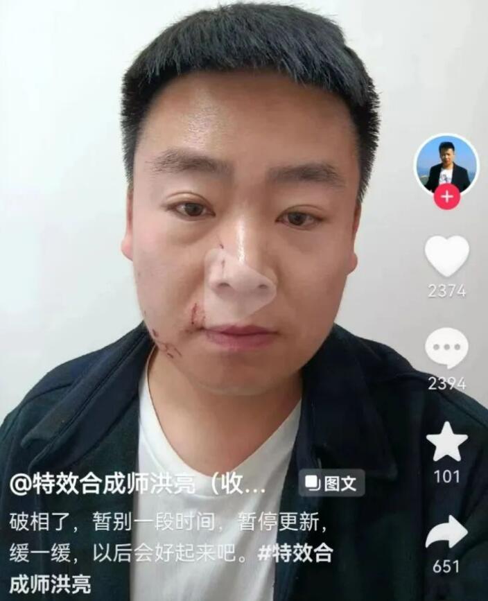 特效合成師洪亮合成女明星親密視頻，被粉絲找上門抓傷，網友：下手輕了