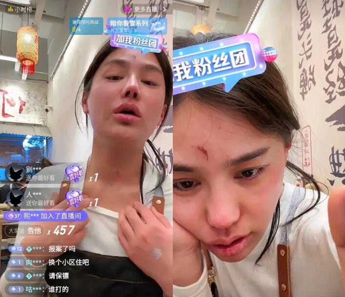 樊小慧遭前婆婆家暴，哭訴對方索要孩子或錢，回應已經進行報警